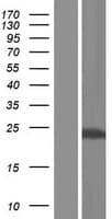 KCNIP2 / KCHIP2 Protein (Over-Expression Lysate Myc-DDK (Flag))