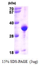 Human VAP33 / VAPA Protein (Recombinant His)