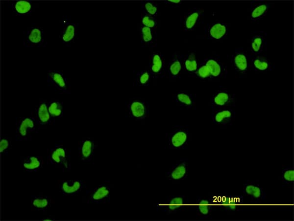 Monoclonal Mouse anti-Human MCM2 Antibody (clone 6A8, IF, WB)