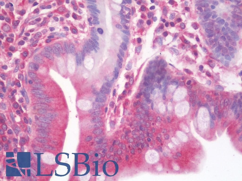 IHC-plus™ Polyclonal Rabbit anti-Human NTRK3 / TRKC Antibody (aa31-61, IHC, WB)