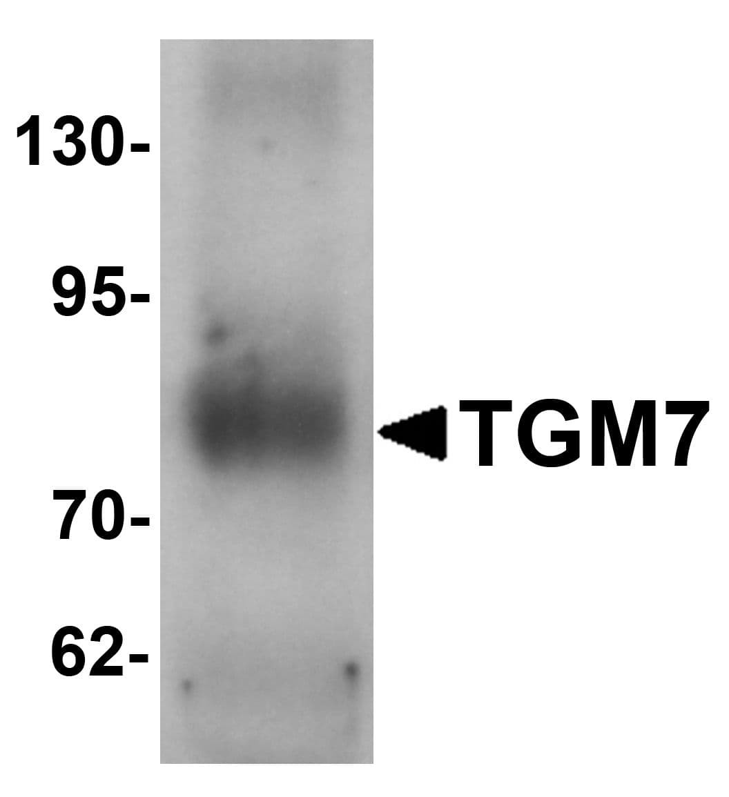 IHC-plus™ TGM7 / Transglutaminase 7 Antibody