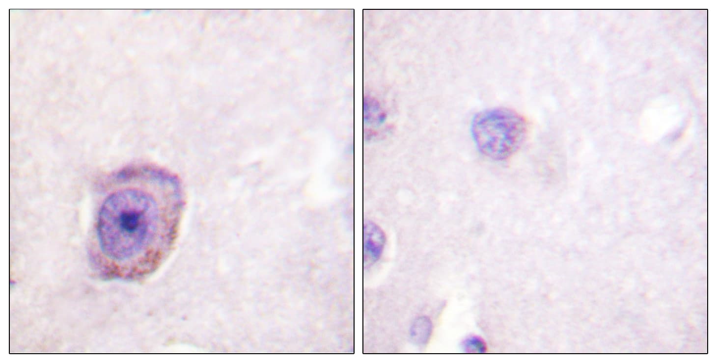 Rhodopsin / RHO Antibody (phospho-Ser334)