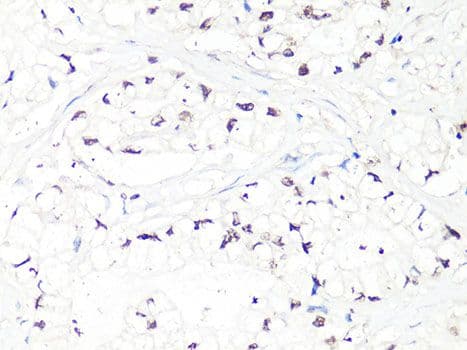 MTA2 Antibody
