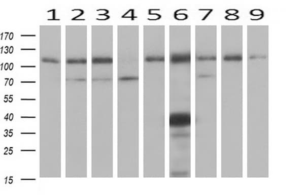 ADH2 / ADH1B Antibody (clone OTI4F12)