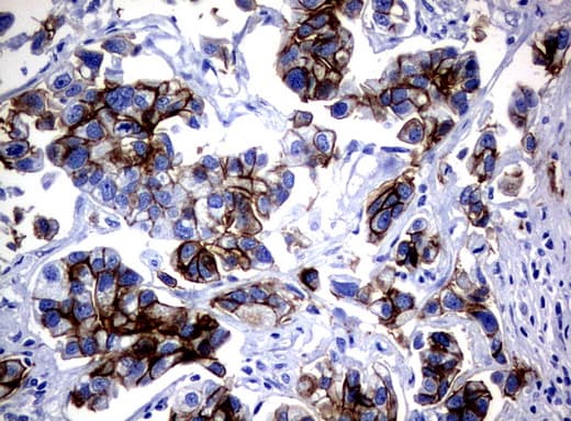EGFR Antibody (clone UMAB95)