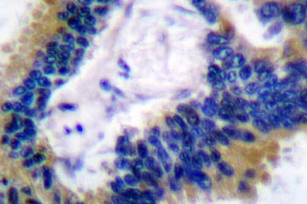 BIK Antibody (Met27)