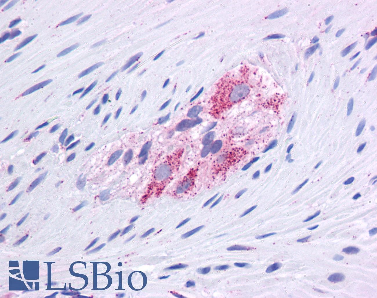 GLUD1/Glutamate Dehydrogenase Antibody (aa182-231)