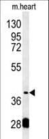 Polyclonal Rabbit anti-Human PON2 Antibody (aa74-101, IHC, IF, WB)