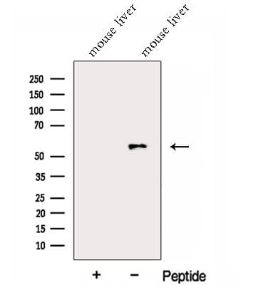 Alpha Fucosidase / FUCA1 Antibody
