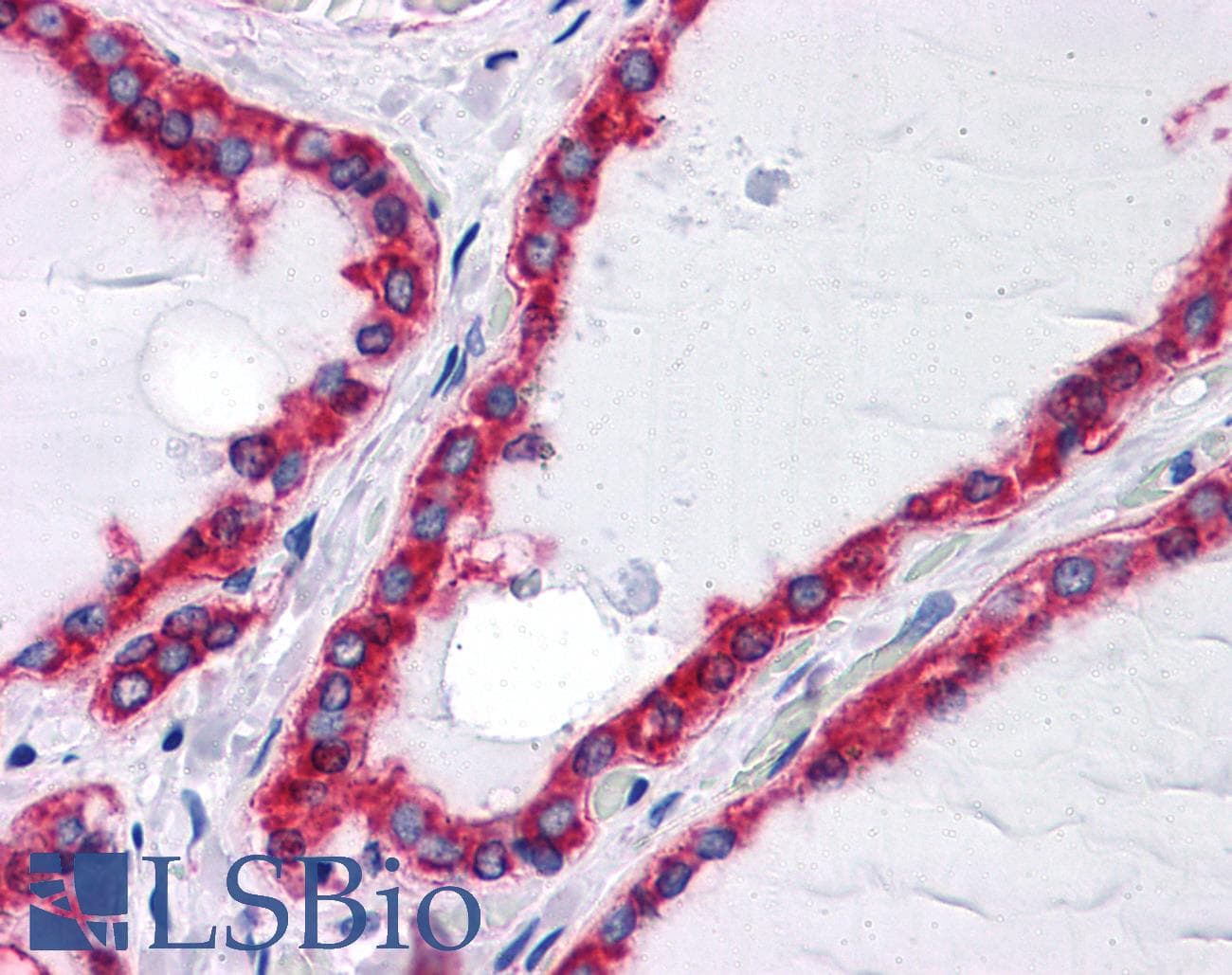 IHC-plus™ Monoclonal Mouse anti-Human HSPA5 / GRP78 / BiP Antibody (clone 4E3, aa525-628, IHC, WB)