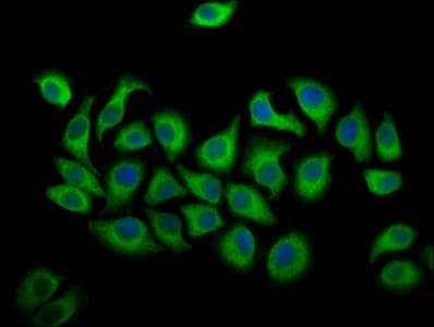 Polyclonal Rabbit anti-Human ALOX12 / 12 Lipoxygenase Antibody (IHC, IF, WB)