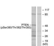 PTEN Antibody (phospho-Ser380/)