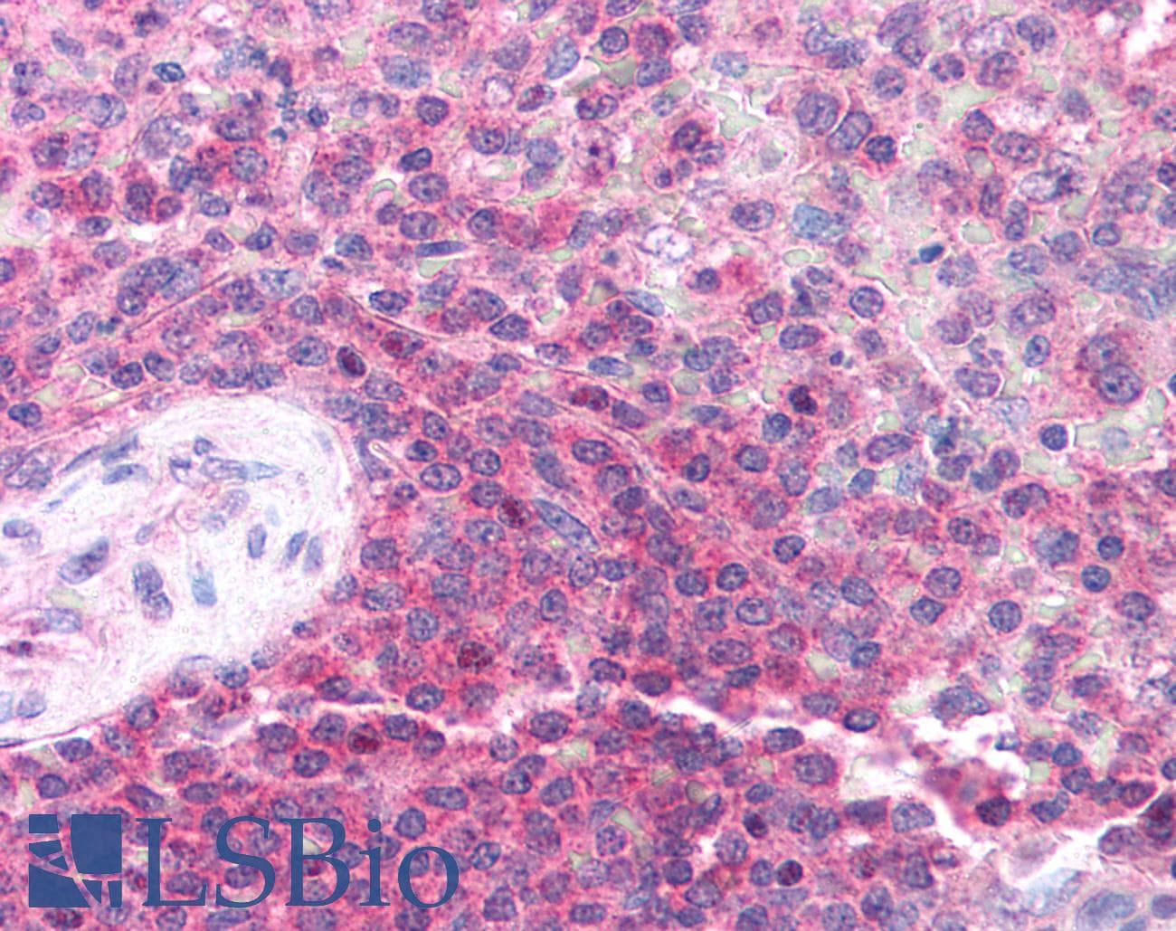 Polyclonal Rabbit anti-Human HT2A / TRIM32 Antibody (aa549-598, IHC, WB)