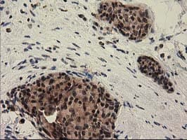 PYCRL Antibody (clone OTI8H6)