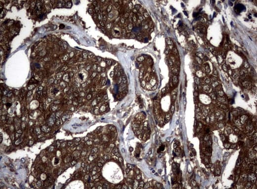 NME1 / NM23 Antibody (clone UMAB91, Carrier-free)