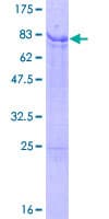 Human IRX2 Protein (Recombinant GST, N-terminus)