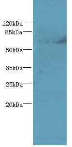TTC30B Antibody