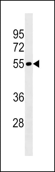 Polyclonal Rabbit anti-Human LRRIQ4 Antibody (aa1-30, WB)