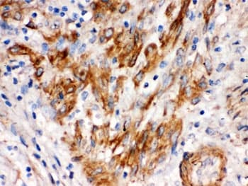Polyclonal Rabbit anti-Human SFRP4 Antibody (IHC, WB)