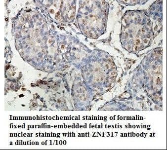 Polyclonal Rabbit anti-Human ZNF317 Antibody (aa58-266, IHC, WB)