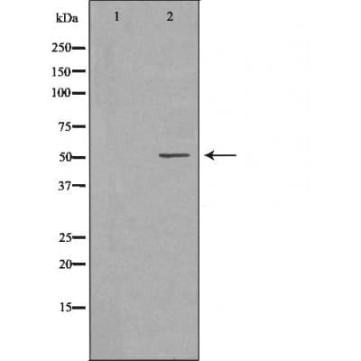 MMP8 Antibody