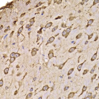 Polyclonal Rabbit anti-Human RPS14 / Ribosomal Protein S14 Antibody (IHC, IF, WB)