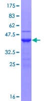 Human UBE2D1 / UBCH5 Protein (Recombinant GST)