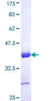 Human XRCC1 Protein (Recombinant GST, N-terminus)