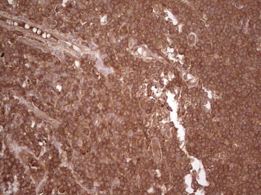 UBE2D2 / UBCH5B Antibody (clone OTI1D11)
