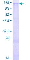 Human ZNF473 Protein (Recombinant GST)