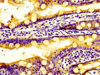 Polyclonal Rabbit anti-Human SIPR2 / S1P2 / EDG5 Antibody (IHC, WB)