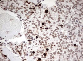 Monoclonal Mouse anti-Human TOP2A / Topoisomerase II Alpha Antibody (clone OTI2D12, aa1100-1531, IHC, WB)