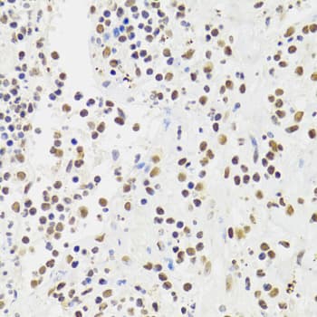 Polyclonal Rabbit anti-Human XRCC6 / Ku70 Antibody (IHC, IF, WB)