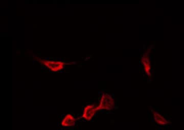 CCR5 Antibody (phospho-Ser336)