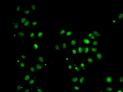 IHC-plus™ MORF4L1 / MRG15 Antibody