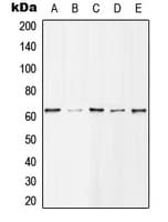 HDAC1 Antibody (phospho-Ser421)