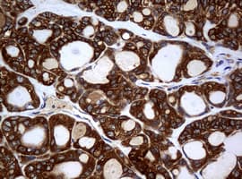 NME1 / NM23 Antibody (clone OTI3F2, Carrier-free)