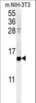 Polyclonal Rabbit anti-Human CRABP1 / CRABP Antibody (aa90-118, IHC, WB)