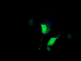 CTAG1B / NY-ESO-1 Antibody (clone OTI4F1)
