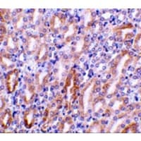 Polyclonal Rabbit anti-Mouse DFFB Antibody (IHC, IF, WB)