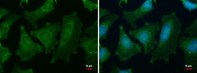 PGM1 / Phosphoglucomutase 1 Antibody (aa116-404)