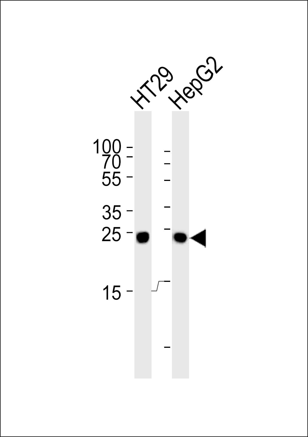 GCG / Glucagon Antibody (aa119-148)