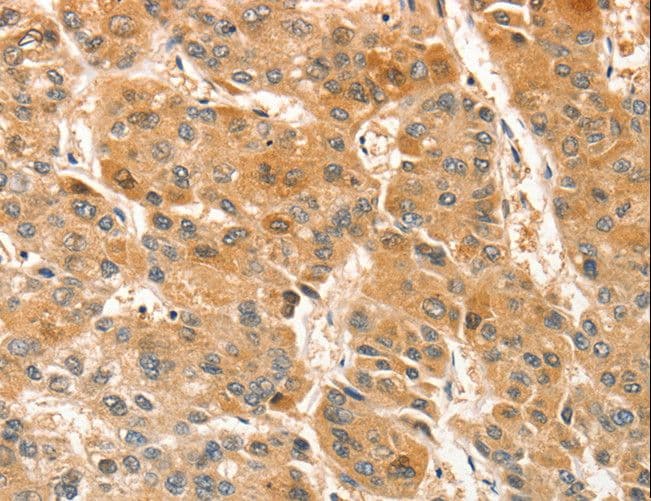 Aprataxin / APTX Antibody