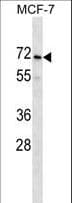 PRAMEF2 Antibody (aa388-417)