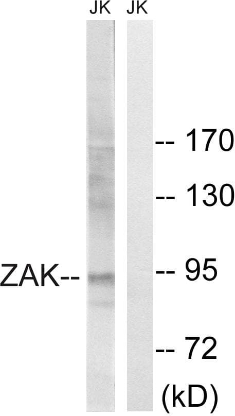 ZAK / MLTK Antibody (p165)