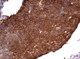 EGFR Antibody (aa900-1210, clone OTI1B10)