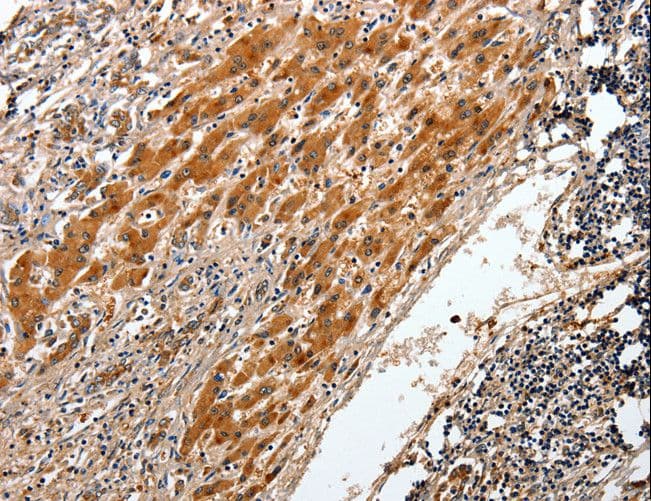 BCL2 / Bcl-2 Antibody