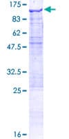 Human AOPEP / Aminopeptidase O Protein (Recombinant GST)