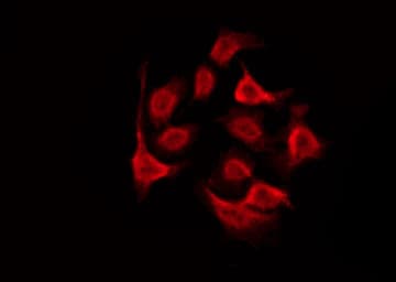 GALR2 / Galanin Receptor 2 Antibody