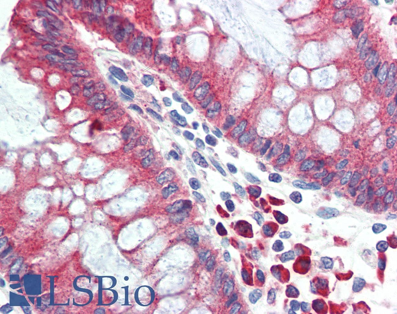 IHC-plus™ Polyclonal Rabbit anti-Rat HYOU1 / ORP150 Antibody (C-Terminus, IHC, WB)